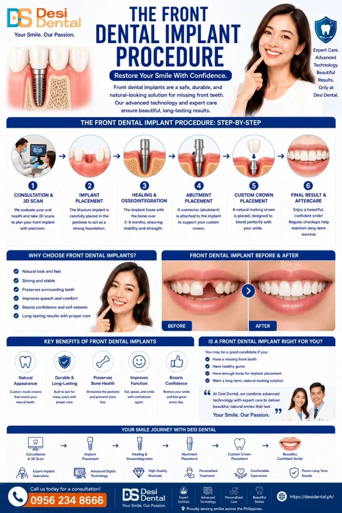 The Front Dental Implant Procedure