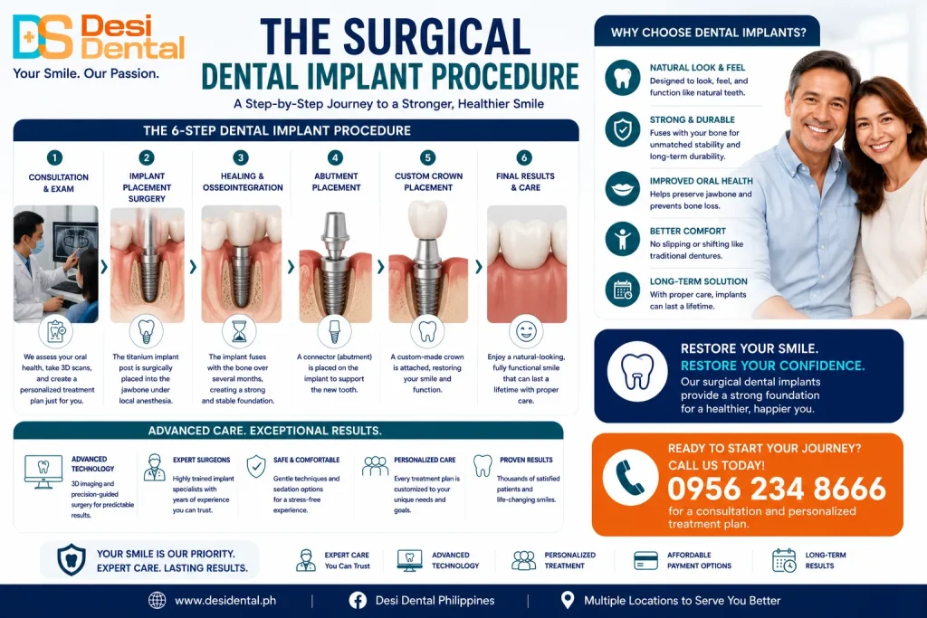 The Surgical Dental Implant Procedure