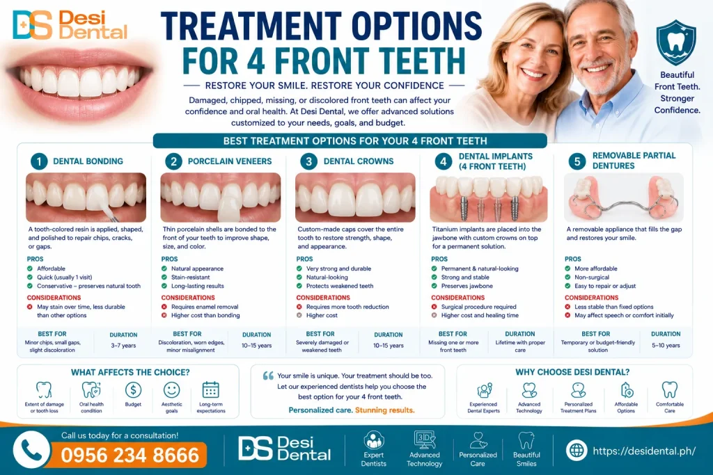 Treatment Options for 4 Front Teeth