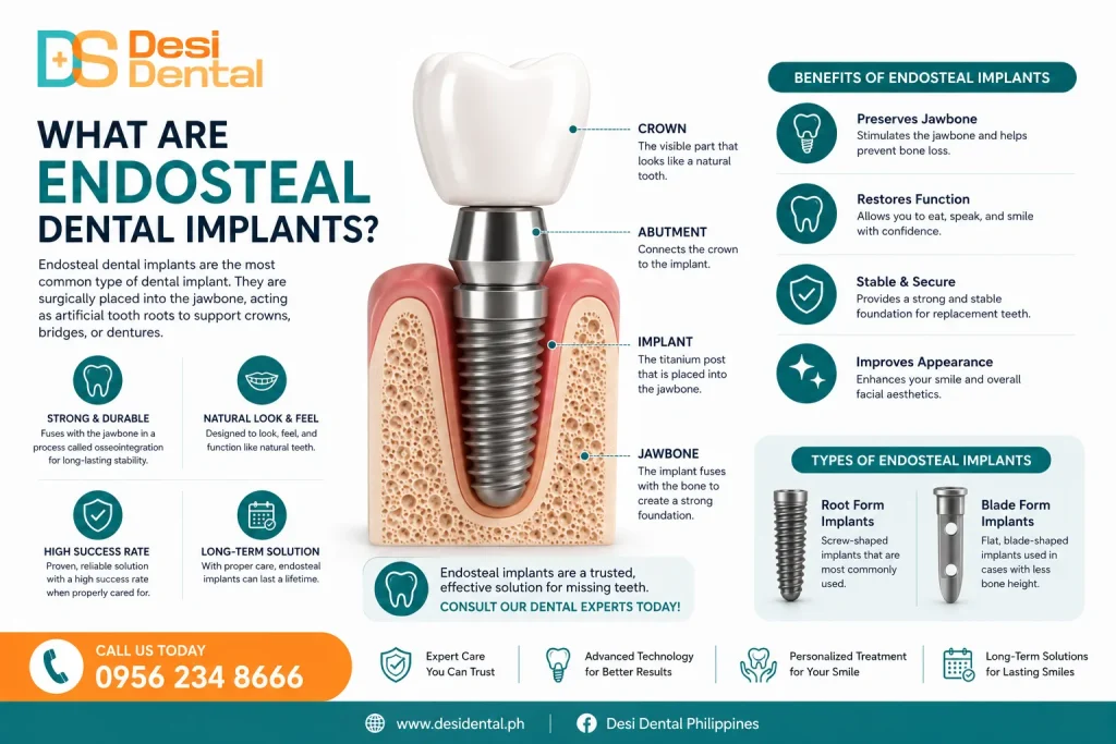 What Are Endosteal Dental Implants