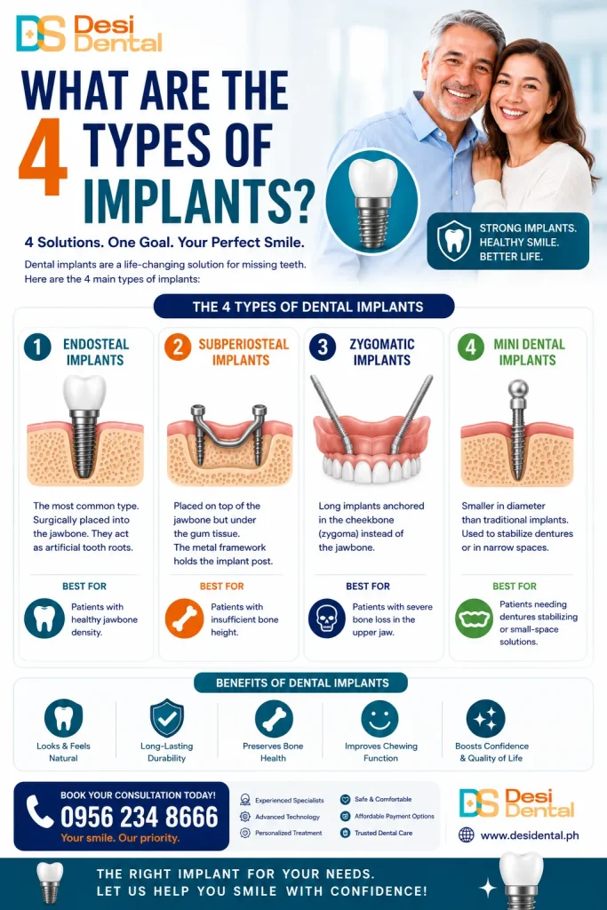 What are the 4 types of implants
