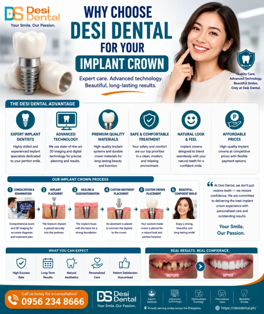 Why Choose Desi Dental for Your Implant Crown