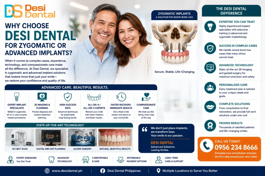 Why Choose Desi Dental for Zygomatic or Advanced Implants