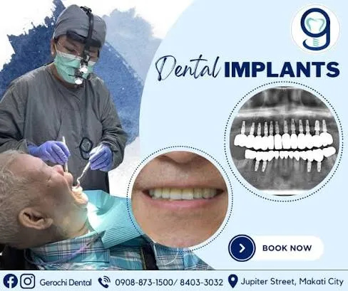Gerochi Dental & Implant Center