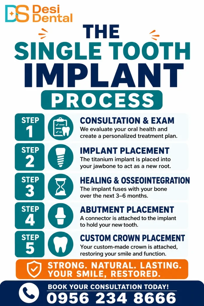 The Single Tooth Implant Process