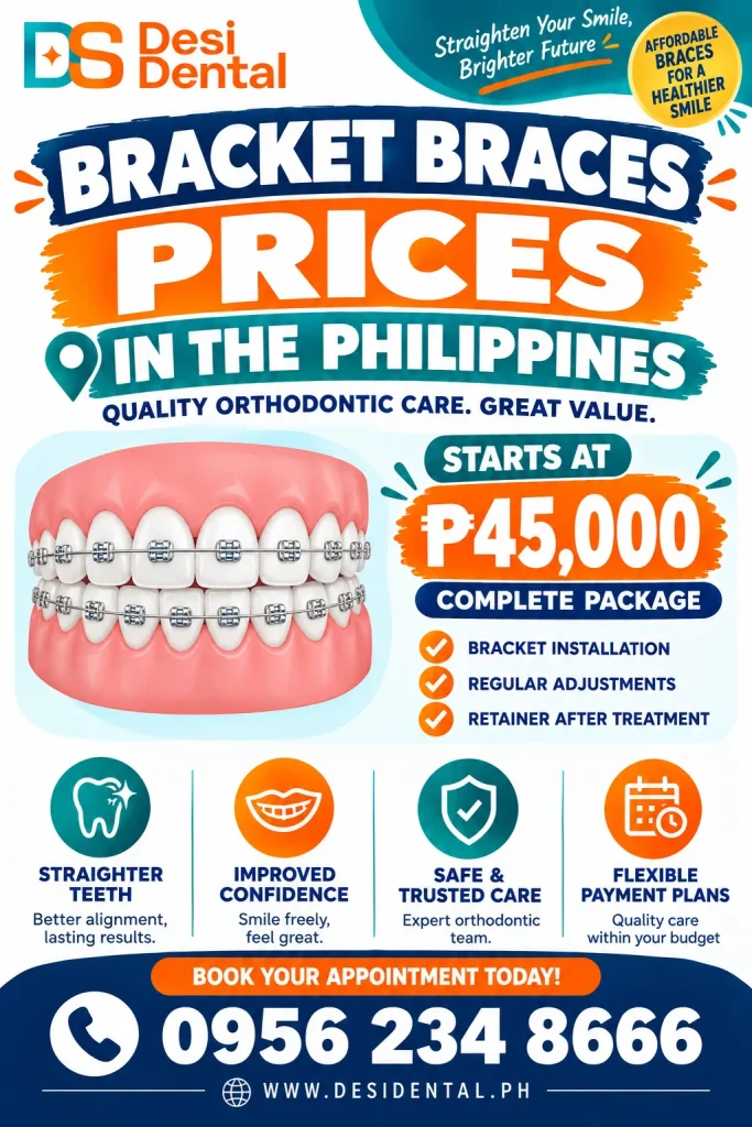 Bracket Braces Prices
