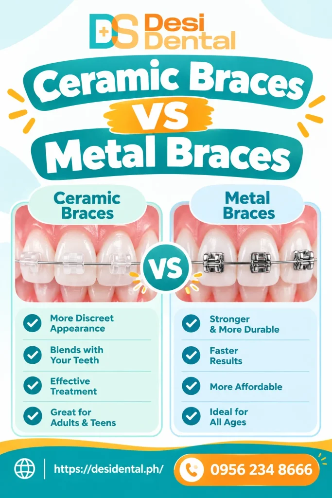 Ceramic Braces vs Metal Braces