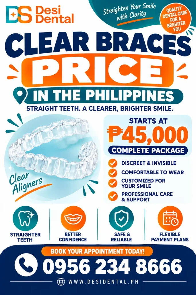 Clear Braces Price