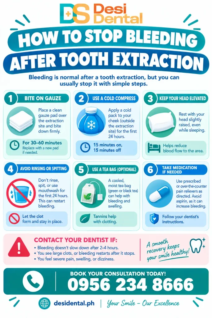 How to Stop Bleeding After Tooth Extraction