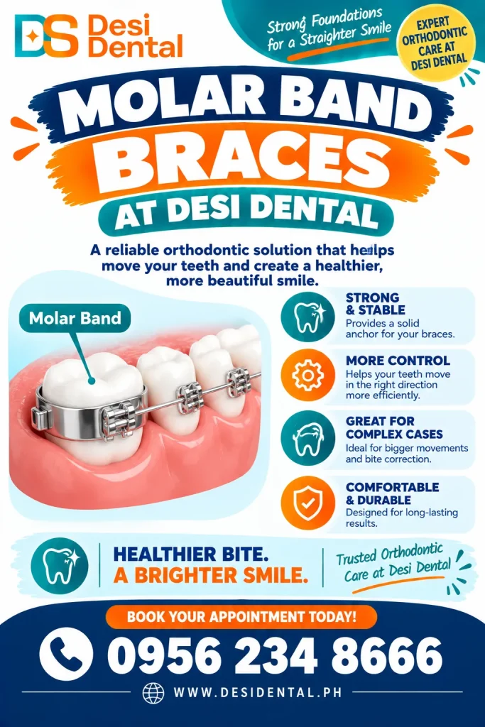 Molar Band Braces at Desi Dental