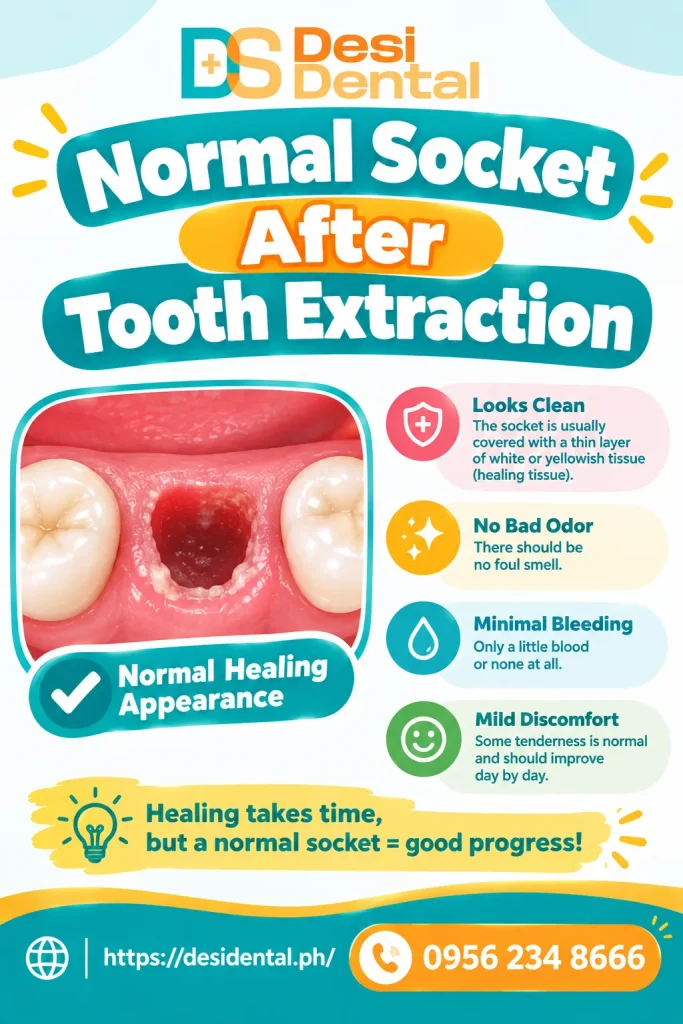Normal Socket After Tooth Extraction