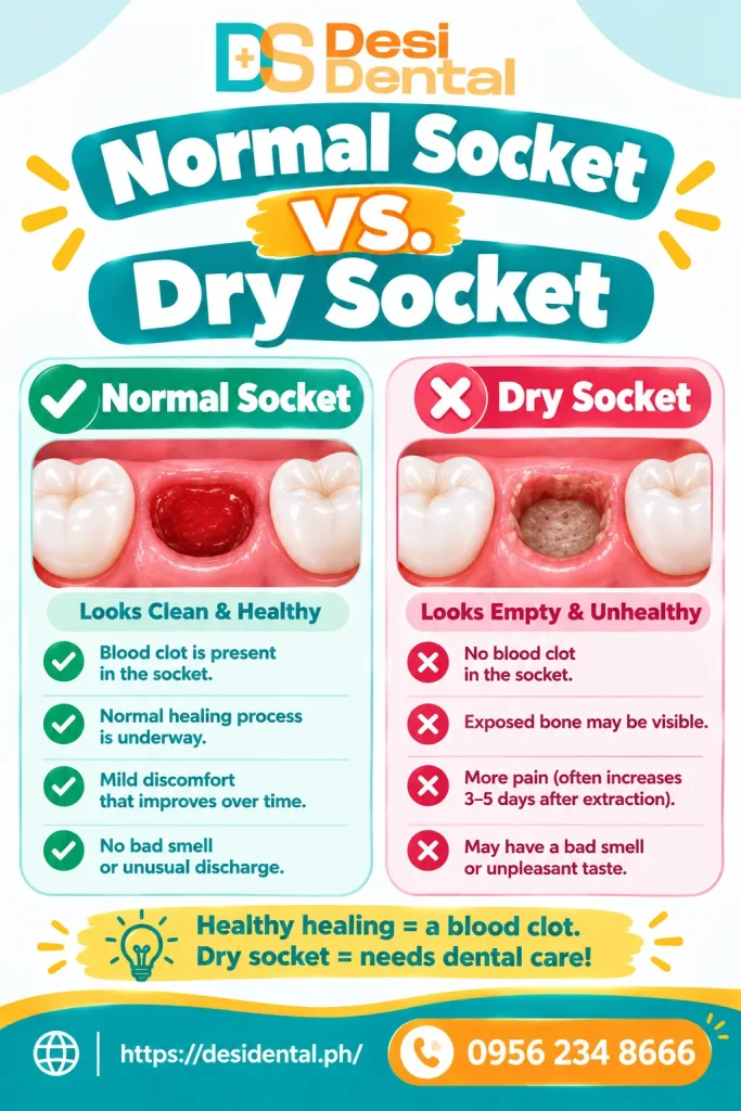 Normal Socket vs. Dry Socket