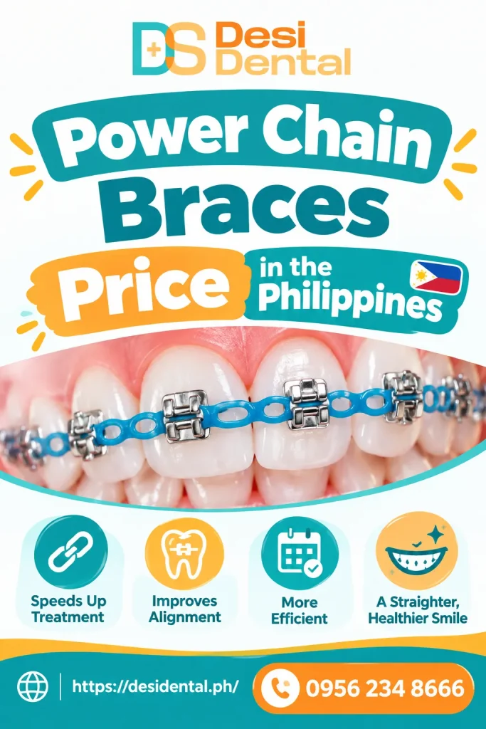 Power Chain Braces Price in the Philippines