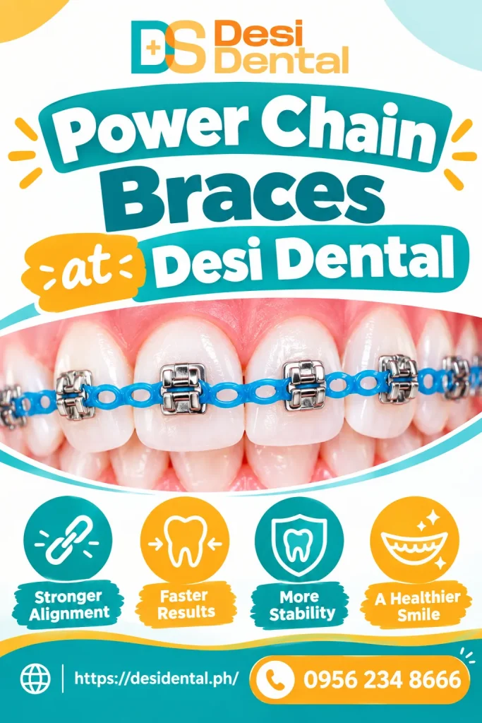 Power Chain Braces at Desi Dental