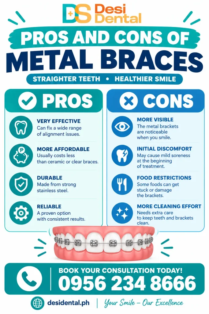Pros and Cons of Metal Braces