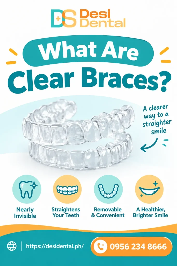What Are Clear Braces