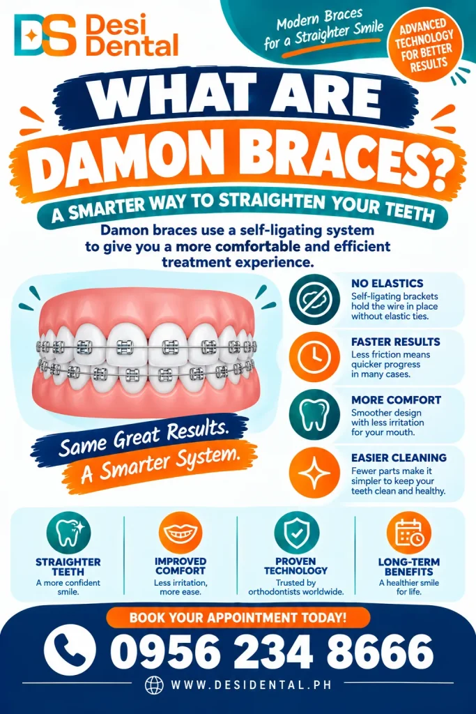 What Are Damon Braces