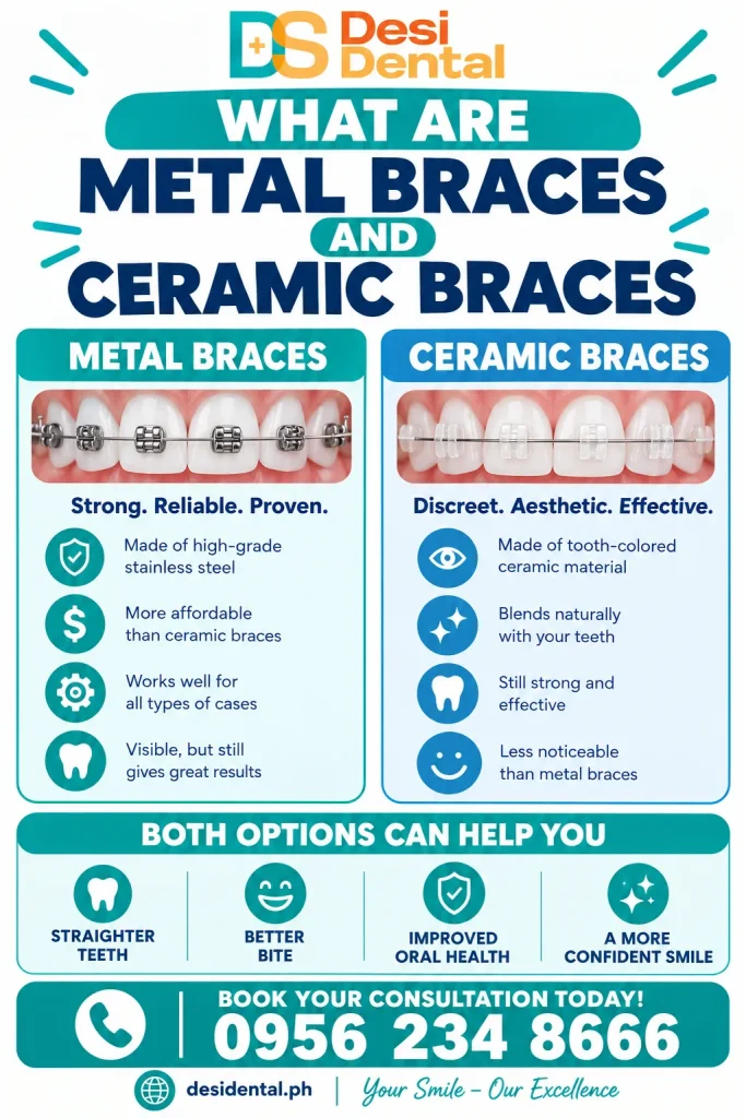 What Are Metal Braces and Ceramic Braces