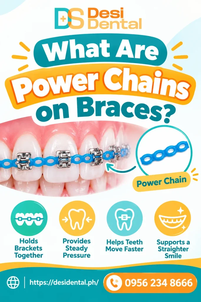 What Are Power Chains on Braces