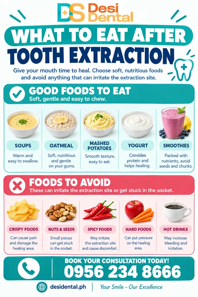 What to Eat After Tooth Extraction